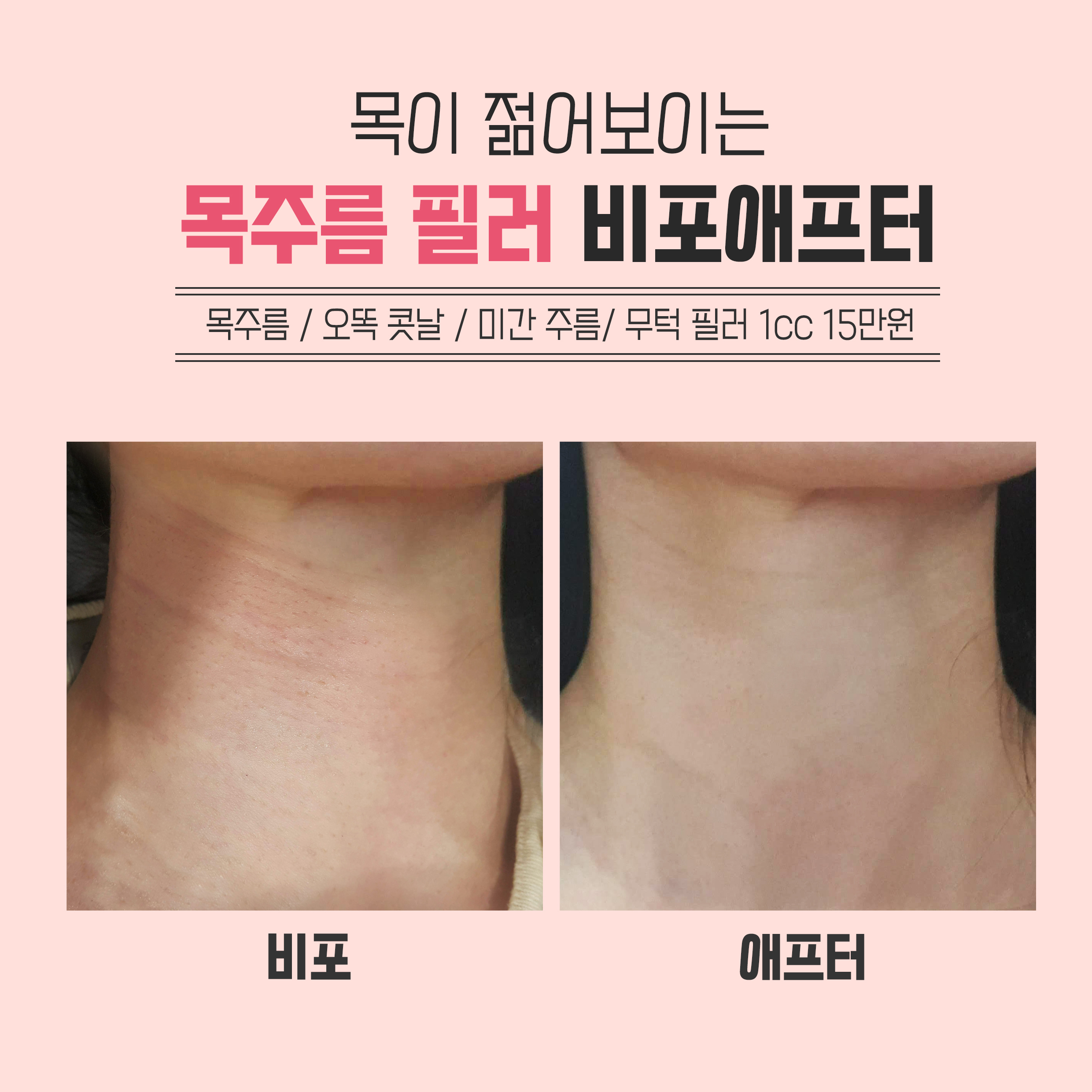 mosaPppI6d.jpeg